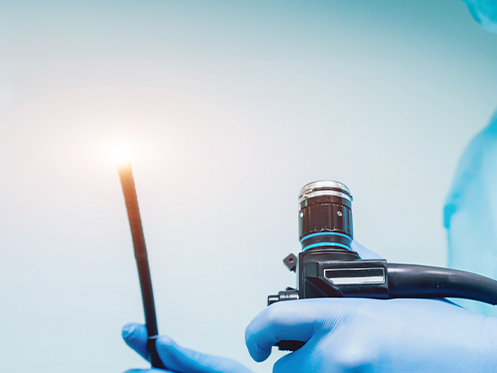 a imagem ilustra uma pessoa usando luvas azuis e segurando um endoscopio